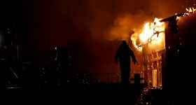 Burn Injuries: Burn Complications